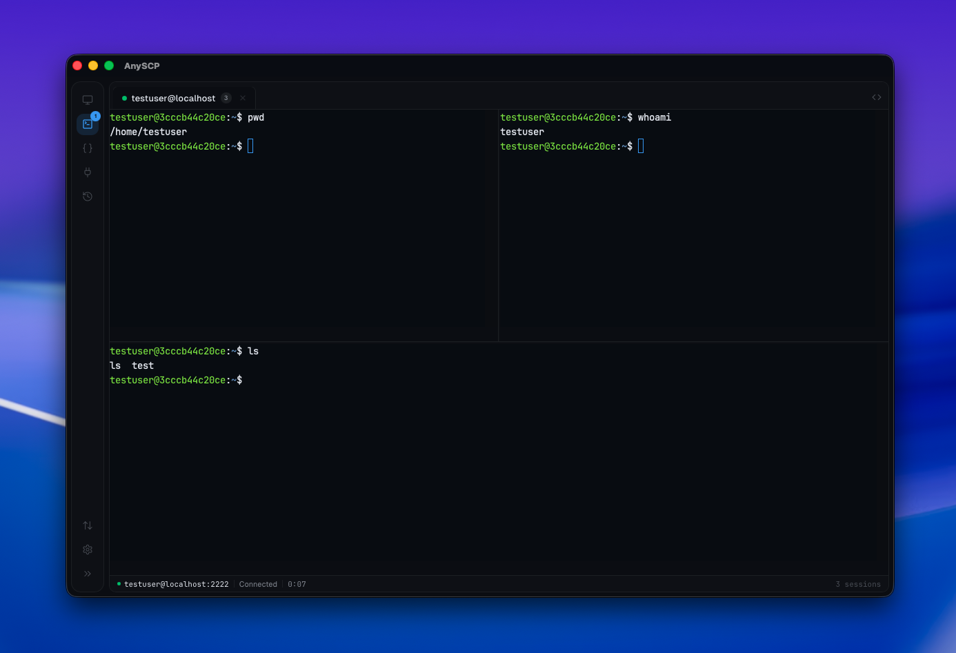 anySCP SSH terminal with GPU-accelerated split panes and tabbed server connections